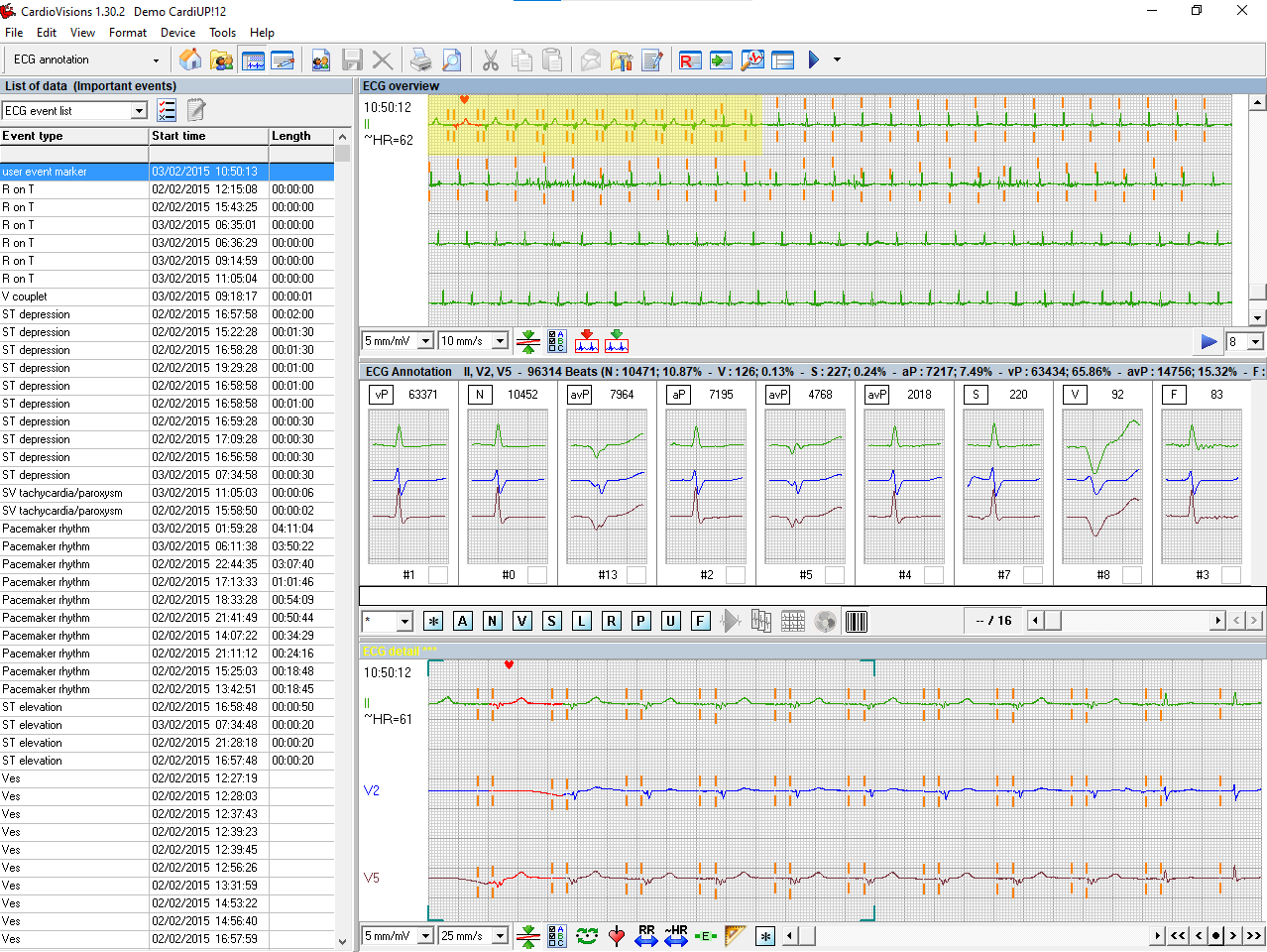 Meditech CardioVisions Software