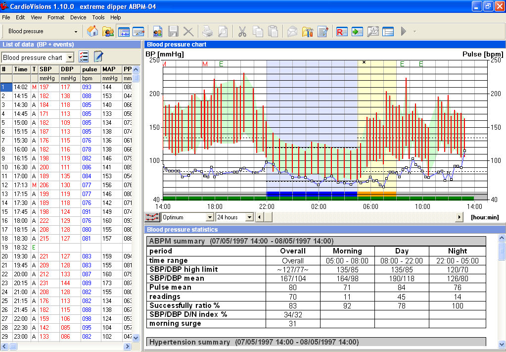 Meditech CardioVisions Software